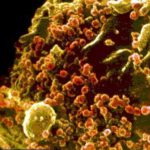 Medicinas contra el sida previenen la infección 7