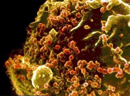 Célula afectada por el virus del VIH Medicinas contra el sida previenen la infección 6