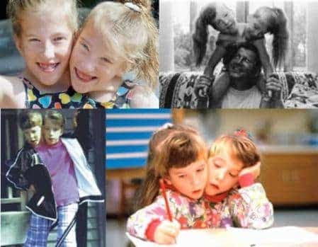La chica de dos cabezas Abigail y Brittany Hensel 1 La chica de dos cabezas Abigail y Brittany Hensel 3