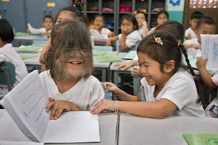 Supattra Sasupan la niña con más pelo del mundo 3 Supattra Sasupan la niña con más pelo del mundo