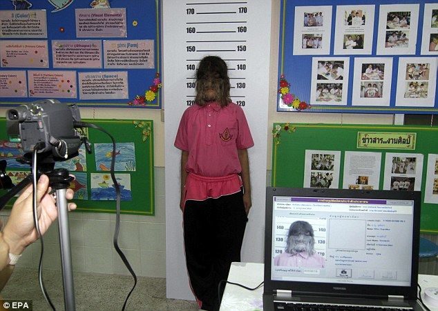 Supattra Sasupan la niña con más pelo del mundo 1 Supattra Sasupan la niña con más pelo del mundo