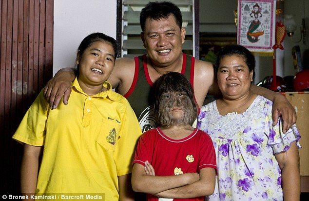 Supattra Sasupan la niña con más pelo del mundo 7 Supattra Sasupan la niña con más pelo del mundo