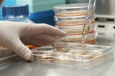 Un tribunal de la UE prohíbe las patentes de células madre embrionarias 5