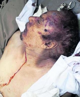 El dilema de qué hacer con el cadáver de Gadafi 2 noticias cadáver de Gadafi muerto