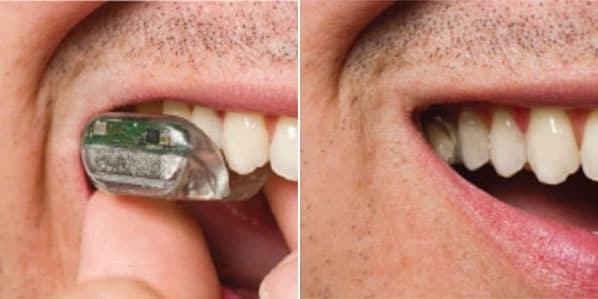 Es posible escuchar através de los dientes 1 Es posible escuchar através de los dientes 2