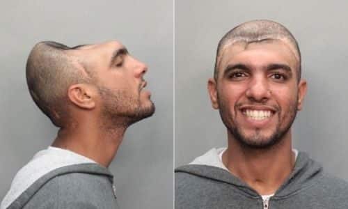  noticias El hombre con media cabeza