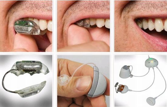Es posible escuchar através de los dientes 2 noticias Es posible escuchar através de los dientes