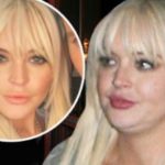 Lindsay Lohan se arruinó la cara con rellenos de grasa 3