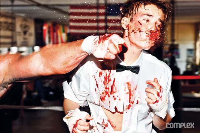 ¡Justin Bieber salvajemente golpeado! 4