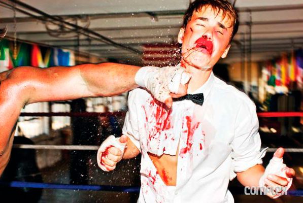 ¡Justin Bieber salvajemente golpeado! 5