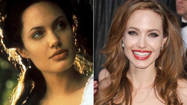 noticias Estrellas antes y después de pasar por el quirófano