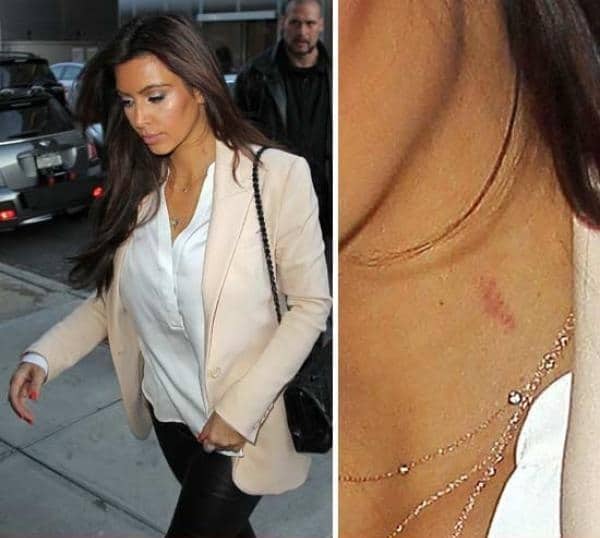 Heridas de amor en el cuello de Kim Kardashian 1 Heridas de amor en el cuello de Kim Kardashian 2