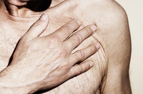 Luz intensa, nuevo tratamiento preventivo contra los infartos 1 Luz intensa, nuevo tratamiento preventivo contra los infartos 2