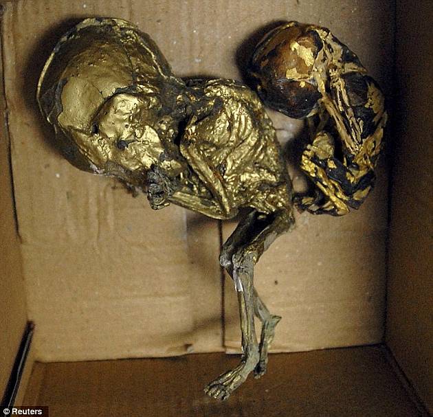 ¡Macabro! hallan fetos envueltos en hojas de oro dentro de una maleta (Advertimos Fotos Impactantes) 4 ¡Macabro! hallan fetos envueltos en hojas de oro dentro de una maleta (Advertimos Fotos Impactantes) 5