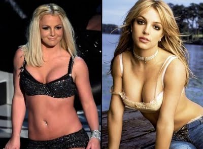 Famosas adictas a las silicona 6