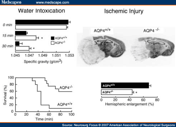 Morir de sobredosis de agua