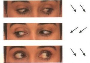 Metodo Natural para Curar Miopia, Hipermetropia, Astigmatismo, Presbicia y Estrabismo 4