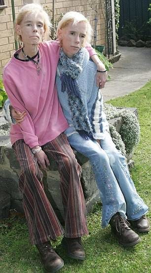 noticias Gemelas anoréxicas mueren juntas, tal como lo habían predicho