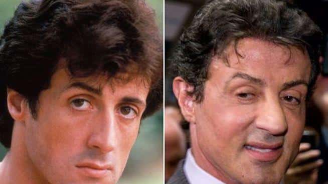 antes-y-despues-de-famosos-11