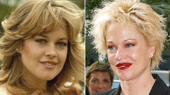 antes-y-despues-de-famosos-5