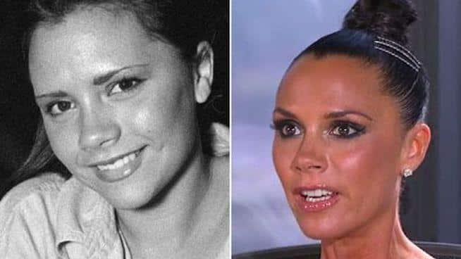 antes-y-despues-de-famosos-6