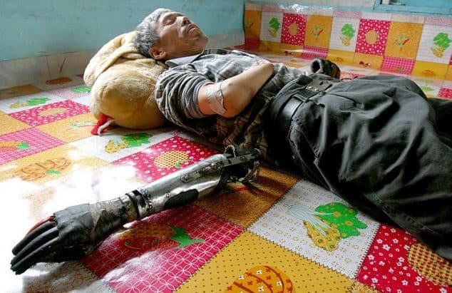 Pescador chino se fabrica sus propias manos biónicas tras perder las suyas en una explosión 2