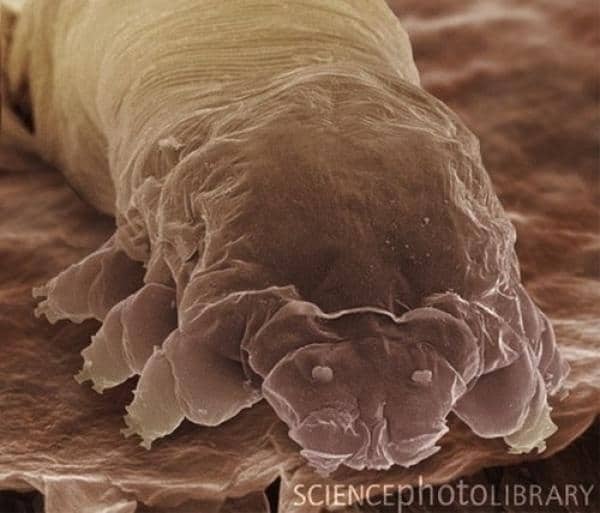 La rosácea podría estar causada por una bacteria presente en la cara 1 La rosácea podría estar causada por una bacteria presente en la cara 2