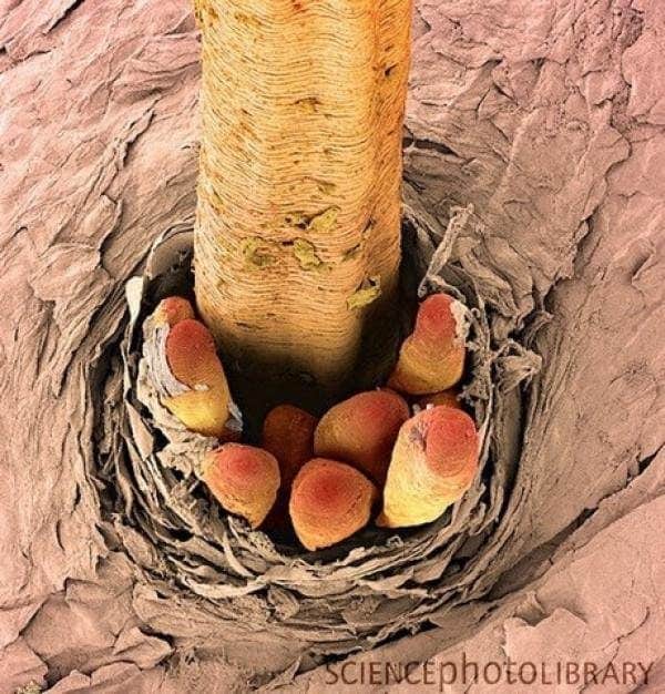 La rosácea podría estar causada por una bacteria presente en la cara 6 noticias La rosácea podría estar causada por una bacteria presente en la cara
