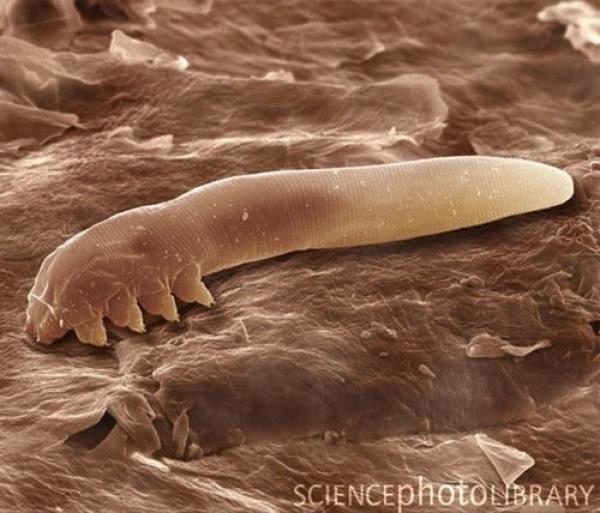 La rosácea podría estar causada por una bacteria presente en la cara 3 noticias La rosácea podría estar causada por una bacteria presente en la cara