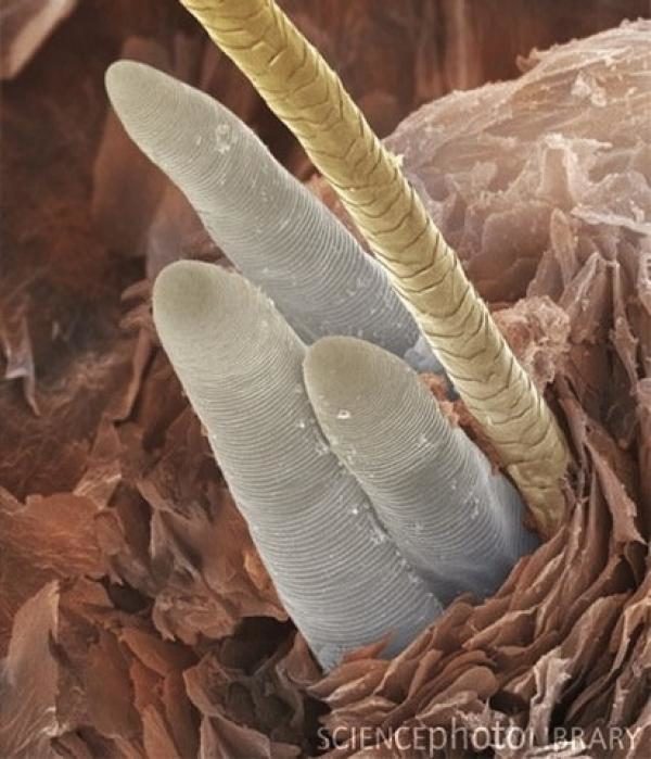La rosácea podría estar causada por una bacteria presente en la cara 4 noticias La rosácea podría estar causada por una bacteria presente en la cara