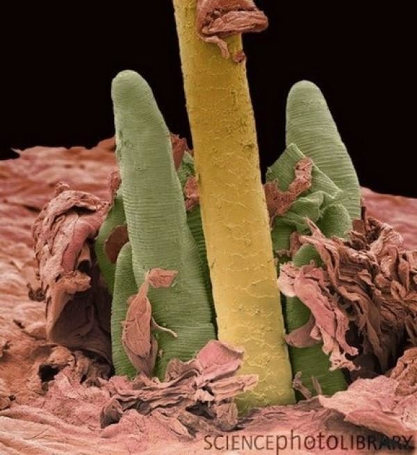 La rosácea podría estar causada por una bacteria presente en la cara 9 noticias La rosácea podría estar causada por una bacteria presente en la cara