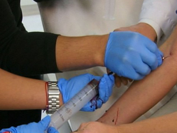 El impactante tratamiento de belleza de Kim Kardashian 3