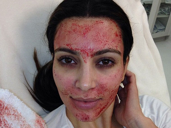 El impactante tratamiento de belleza de Kim Kardashian 7