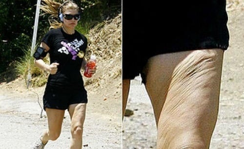Las piernas no tan bellas de las famosas más bellas 1 Las piernas no tan bellas de las famosas más bellas 2