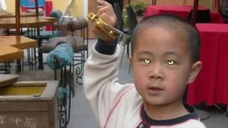 Nong Youhui, el Cat-Boy (Niño Gato) que puede ver en la oscuridad 1 Nong Youhui, el Cat-Boy (Niño Gato) que puede ver en la oscuridad 2