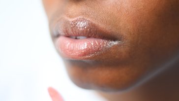 Relleno de labios en Sevilla: mejora tu aspecto 5