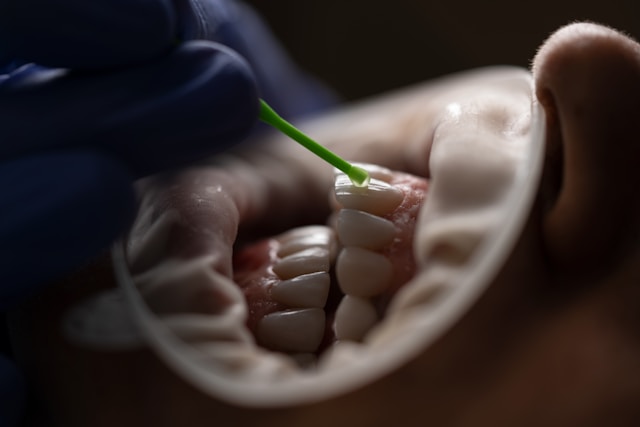 Implantes dentales: mitos y realidades Implantes dentales: mitos y realidades 1